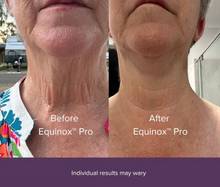Load image into Gallery viewer, Equinox Pro LED Light Mask - Face, Neck, and Chest