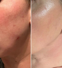 Before and after, Face Forward Brightening Pads