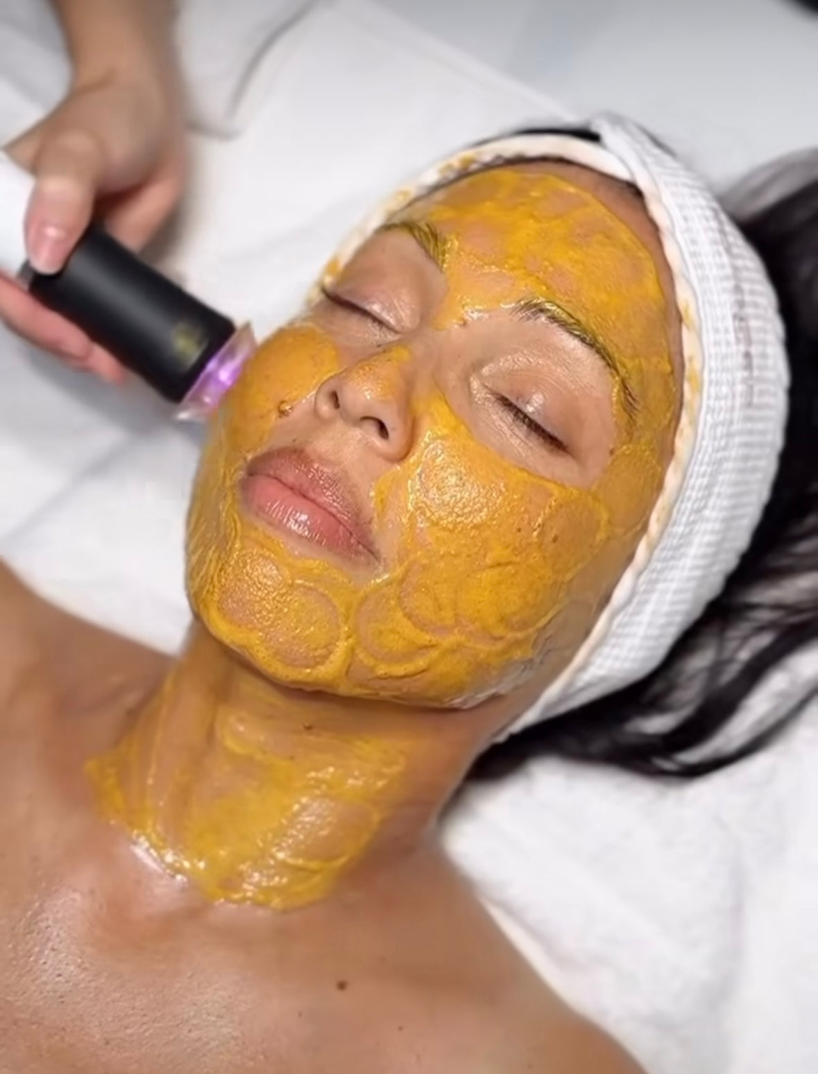 2 Glo2Facial (previously Geneo)