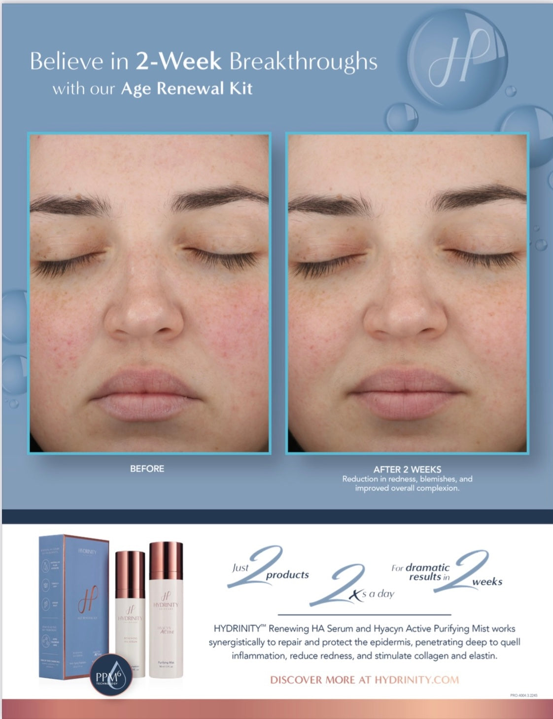 Hydrinity Age Renewal Kit