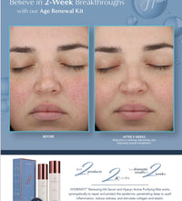 Hydrinity Age Renewal Kit