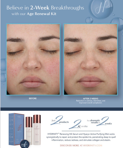 Hydrinity Age Renewal Kit