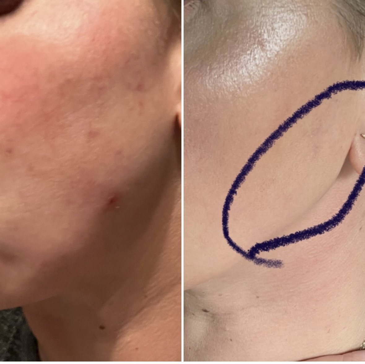 Before and after — texture and clarity